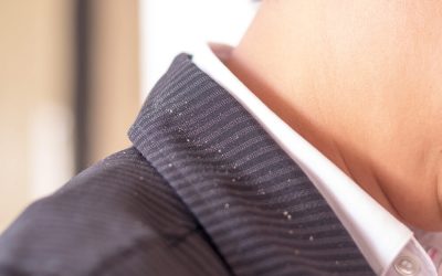 4 Things You Need to Know About Dandruff
