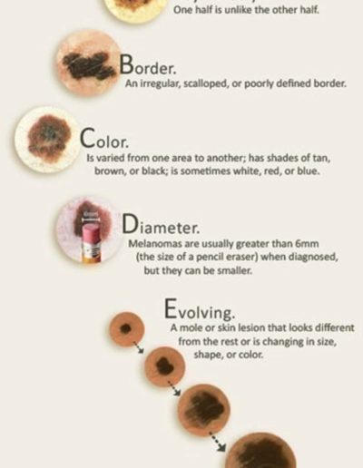 Dermatologist