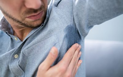 How to Deal with Excessive Sweating
