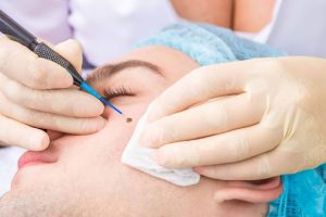 Surgical Dermatology Services